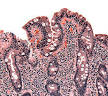 230px-Coeliac_path.jpg