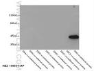 HBZ-Specific Antibody 19995-1-AP | Proteintech