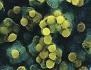 Streptococcus Pyogenes | Health Healths