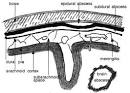 Abscess (<b>Subdural Empyema</b>)