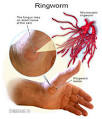 <b>Parasites</b> do not belong to