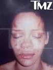 Exclusive On TMZ Rihanna Bruise Face Pic Downloads Chris Brown