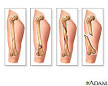 Illustration of <b>fracture</b> types
