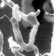 Blood–brain barrier - Wikipedia, the free encyclopedia