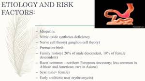 Image result for Pyloric stenosis risk factors