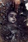 Bhopal gas disaster girl -