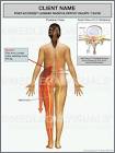 Lumbar <b>radiculopathy</b> may also