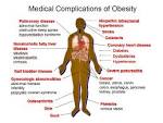 What is <b>Obesity</b>?