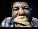 in Aaron Gonzales face