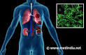 <b>anti</b>-<b>glomerular basement</b>