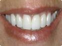 http://t3.gstatic.com/images?q=tbn:ANd9GcTPnyb6jhWnLBqhgYoAIm4lLOS4S--74yiN6QgcS2qWy6-FLe1cRcl69lA