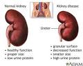 <b>renal insufficiency</b> prior