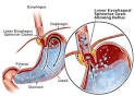 Get Everything Done: Acidity...