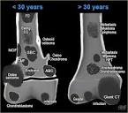 Bone Tumors - Differential diagnosis