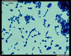 <b>Enterococcus faecalis</b>