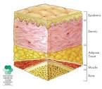 The <b>dermis</b> is the thick,