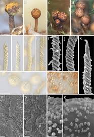 Attēlu rezultāti vaicājumam “Trichia erecta stalked”