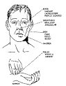 Figure 4-1 Symptoms of Shock