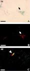 ScienceDirect.com - Brain Research - Sequential upregulation of