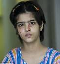 怪病，眼睛流血泪全身渗血。