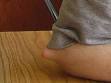Bone tumor - Wikipedia, the free encyclopedia