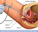 Mayo Clinic medical information and tools for healthy living ...