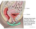 http://graphics8.nytimes.com/images/2007/08/01/health/adam/19094.jpg