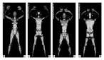 Terahertz Wave, Body Scan Imaging Technology | Herbert W. Perry ...