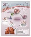 Cytokine Storm and the H5N1 Influenza Pandemic: The Bird Flu