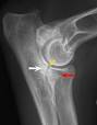 Elbow dysplasia - Wikipedia, the free encyclopedia