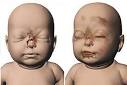 [baby+p]
