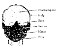 HowStuffWorks "How Brain Death Works"