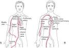 Cardiorespiratory arrest - definition of Cardiorespiratory arrest ...