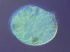Protozoa