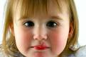 Discovery Health "How to Treat a Fever Blister"