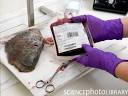 Stem Cell Blog - Private cord blood banking – worth your money ...