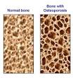 What You Don't Know About Bone Density | Functional Fitness Blog