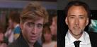 Nicolas Cage, Plastic Surgery