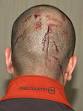 NEW DETAILS ARE RELEASED IN SHOOTING OF TEENAGER - NYTimes.