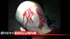 George Zimmerman Tells Trayvon Martin's Parents 'I Am Sorry' - ABC ...