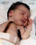 Thumbnail - Baby Fae