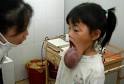 A doctor checks a girl who