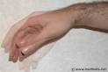 Hand <b>Tremor</b> - Symptom Evaluation