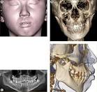 ScienceDirect.com - Seminars in Orthodontics - Progressive