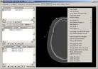 Conquest DICOM software