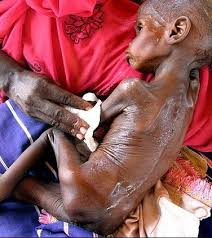 الصومال تموت جوعا !!!! صور Images?q=tbn:ANd9GcTe3KDwaVchAUDP9Gd7gpUnA9gBJLqr1i0fPrsB2LVnKtUTXfXr&t=1