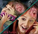 Affinity Primary Site Code (Required) -->. Brain Cancer