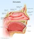 Sinus Infection Signs Symptoms Relief and Treatment  Sinusitis