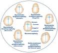 <b>synostotic</b>-cephaly-web
