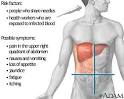 What causes <b>hepatitis</b> C?